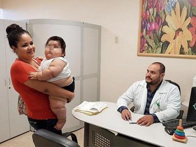 Investiga IMSS caso de bebé que a los 10 meses pesa 28 kilos